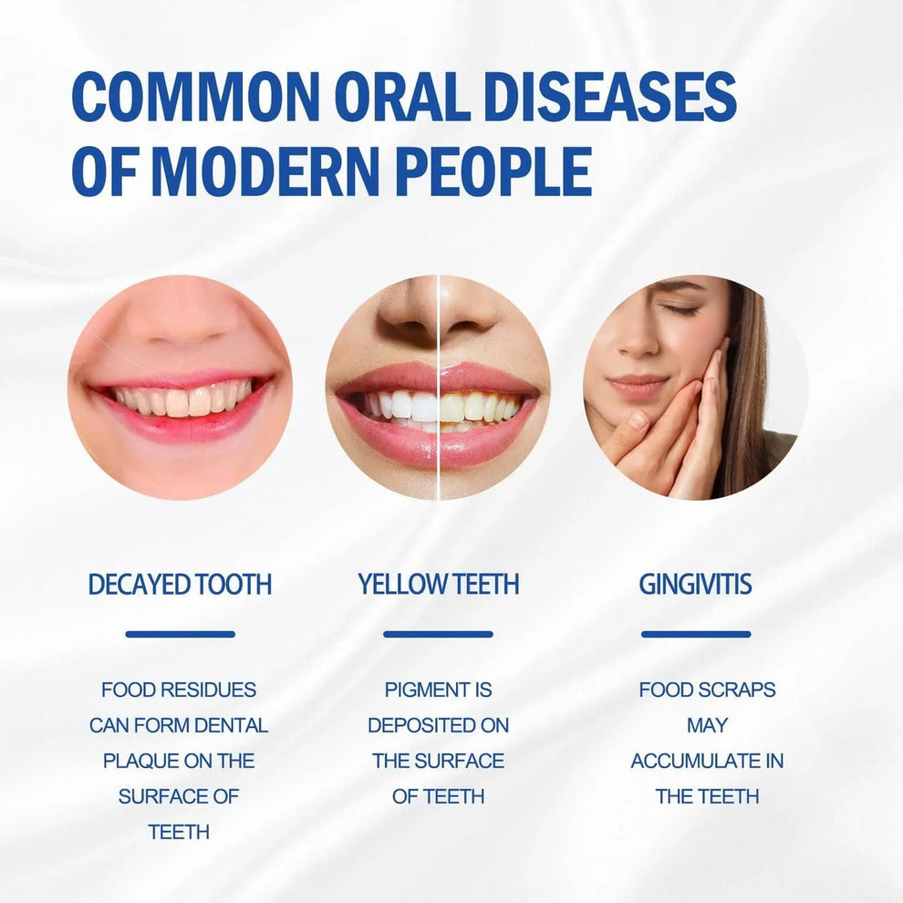 SP-4 Probiotic Brightening & Stain Removing Toothpaste (Buy 1 Get 1 Free)